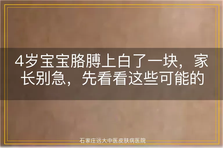 4岁宝宝胳膊上白了一块，家长别急，先看看这些可能的原因
