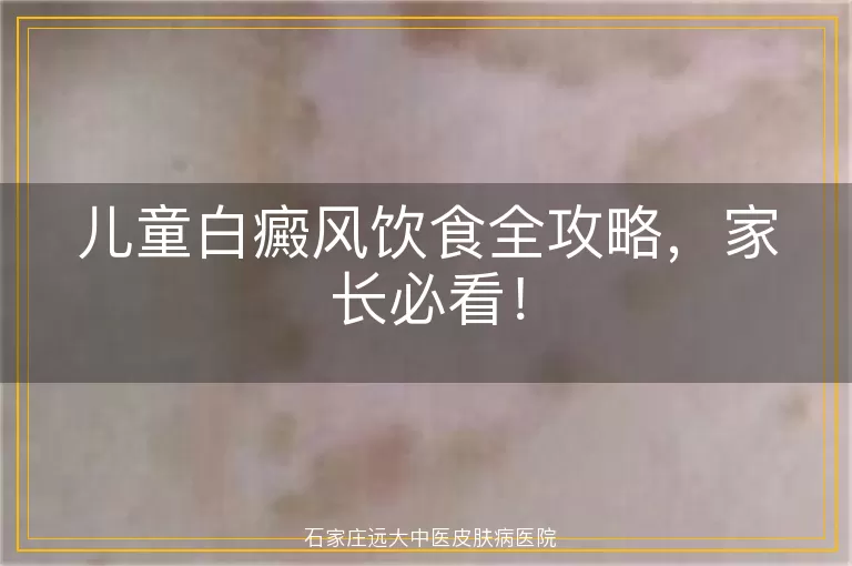 儿童白癜风饮食全攻略，家长必看！