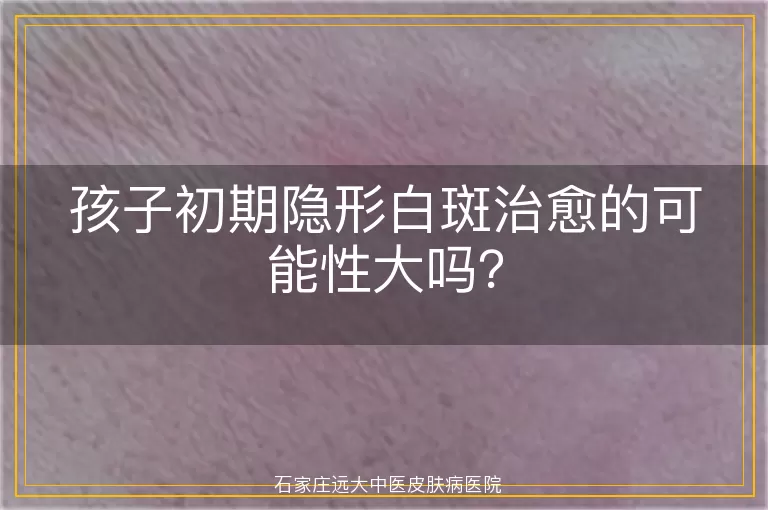 孩子初期隐形白斑治愈的可能性大吗？