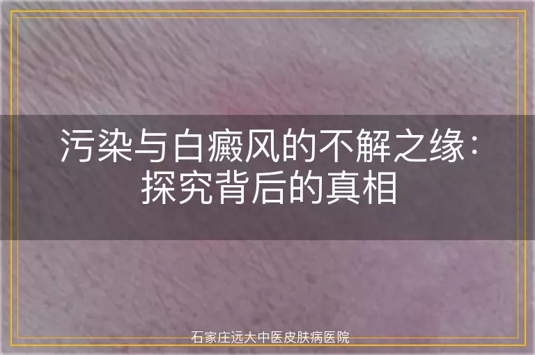 污染与白癜风的不解之缘：探究背后的真相