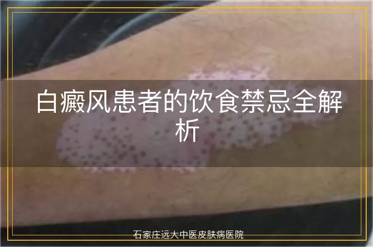 白癜风患者的饮食禁忌全解析