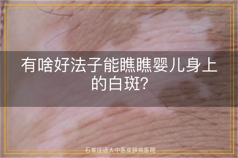 有啥好法子能瞧瞧婴儿身上的白斑？