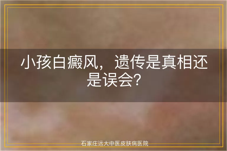 小孩白癜风，遗传是真相还是误会？