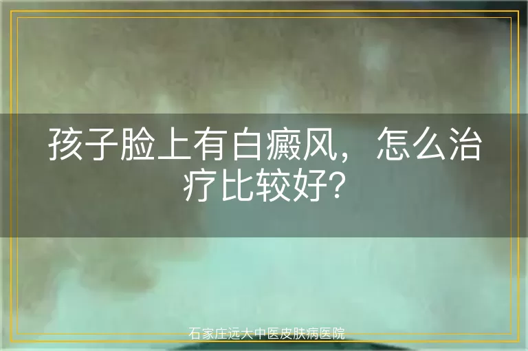 孩子脸上有白癜风，怎么治疗比较好？