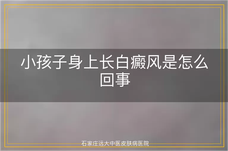 小孩子身上长白癜风是怎么回事