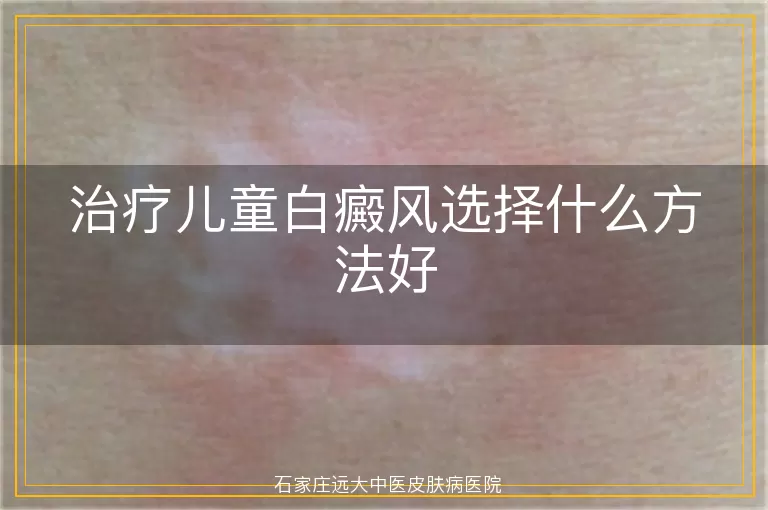 治疗儿童白癜风选择什么方法好