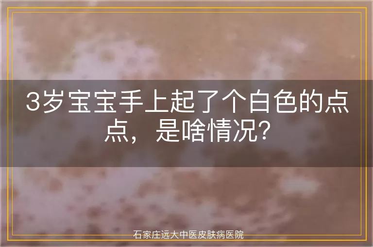 3岁宝宝手上起了个白色的点点，是啥情况？