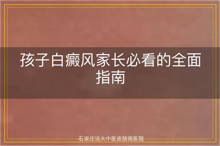 孩子白癜风家长必看的全面指南