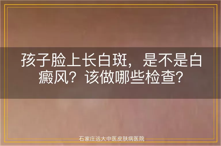 孩子脸上长白斑,是不是白癜风?该做哪些检查?