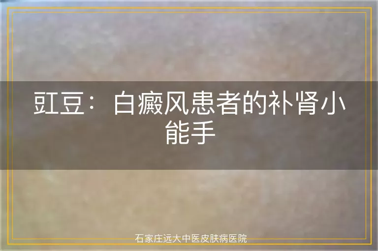 豇豆：白癜风患者的补肾小能手