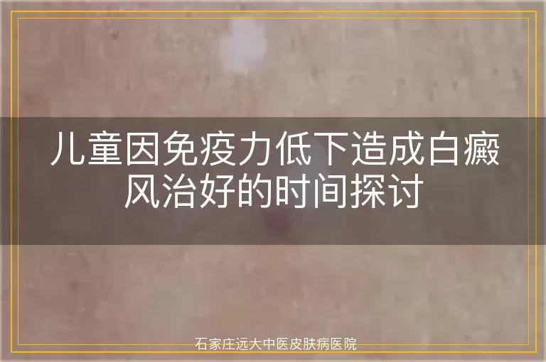 儿童因免疫力低下造成白癜风治好的时间探讨