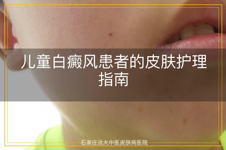 儿童白癜风患者的皮肤护理指南