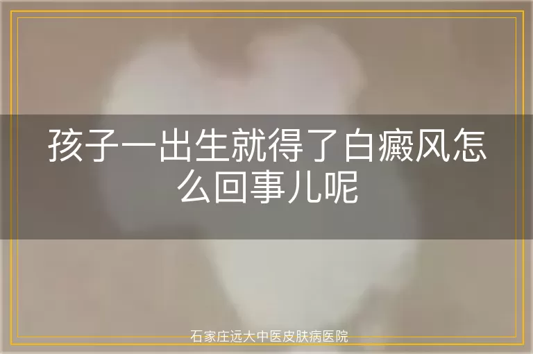 孩子一出生就得了白癜风怎么回事儿呢