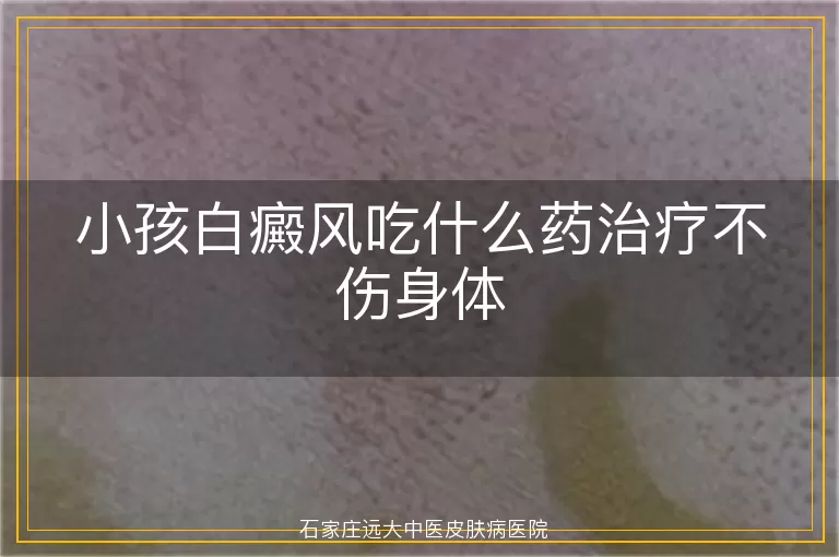 小孩白癜风吃什么药治疗不伤身体