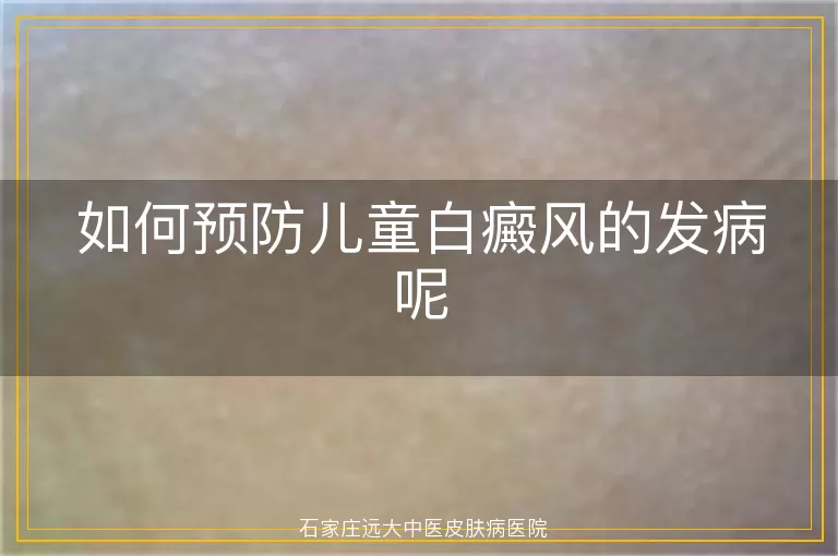 如何预防儿童白癜风的发病呢