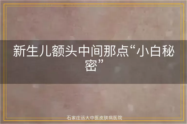 新生儿额头中间那点“小白秘密”