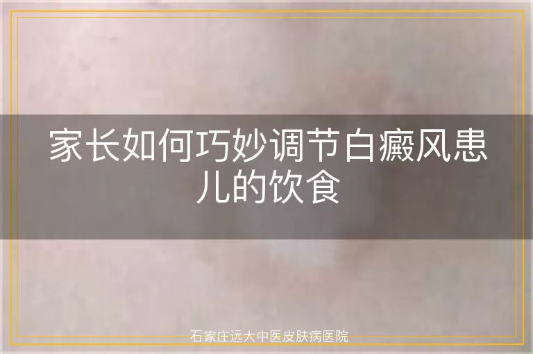 家长如何巧妙调节白癜风患儿的饮食