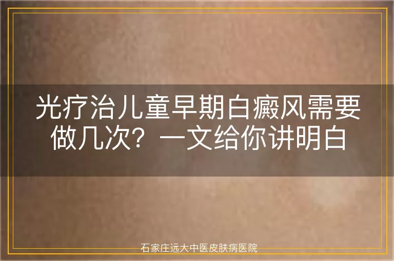 光疗治儿童早期白癜风需要做几次？一文给你讲明白