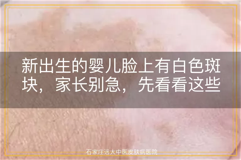 新出生的婴儿脸上有白色斑块，家长别急，先看看这些可能的原因