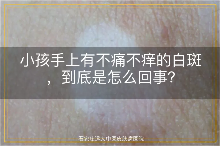 小孩手上有不痛不痒的白斑，到底是怎么回事？