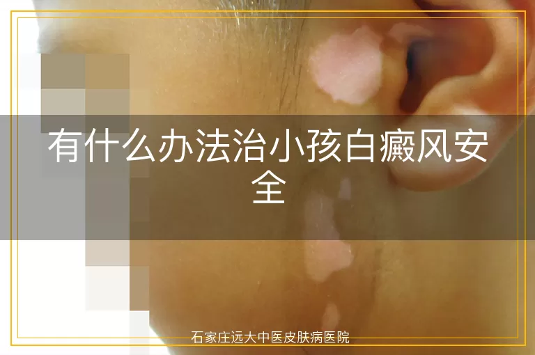 有什么办法治小孩白癜风安全
