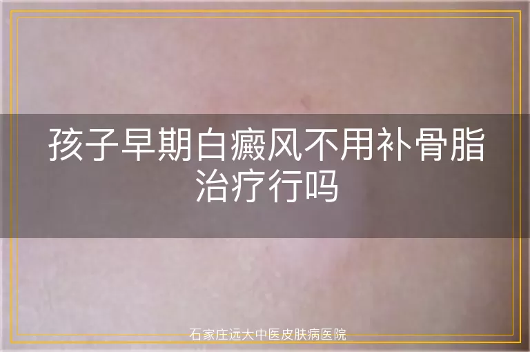 孩子早期白癜风不用补骨脂治疗行吗