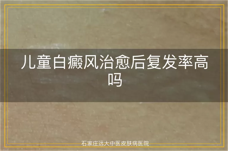 儿童白癜风治愈后复发率高吗