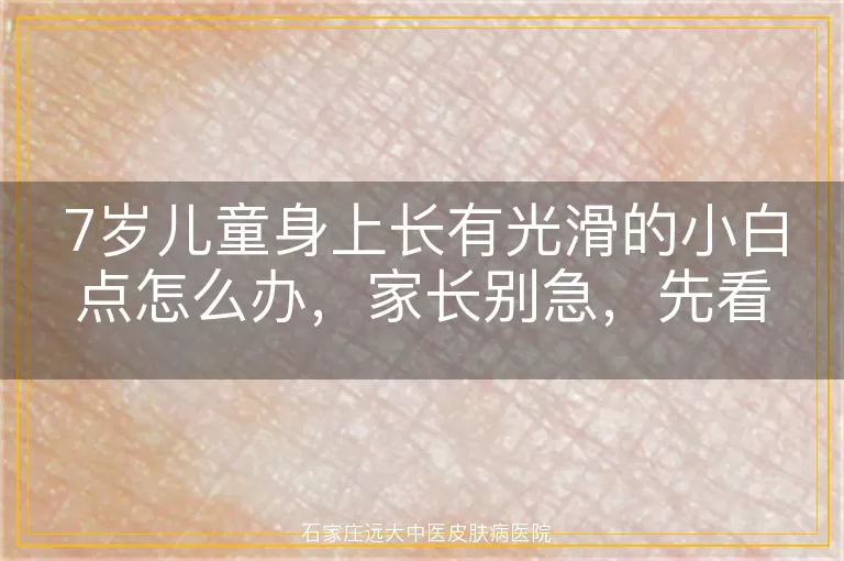 7岁儿童身上长有光滑的小白点怎么办，家长别急，先看这里！