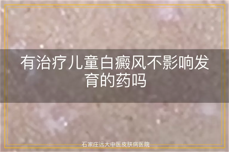 有治疗儿童白癜风不影响发育的药吗