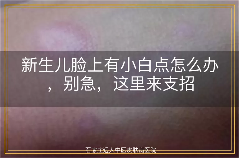 新生儿脸上有小白点怎么办，别急，这里来支招
