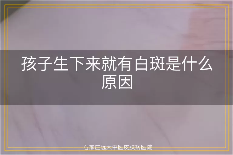 孩子生下来就有白斑是什么原因