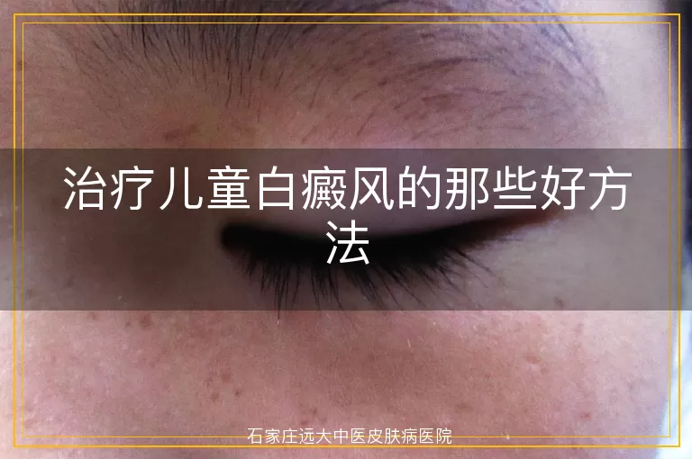 治疗儿童白癜风的那些好方法