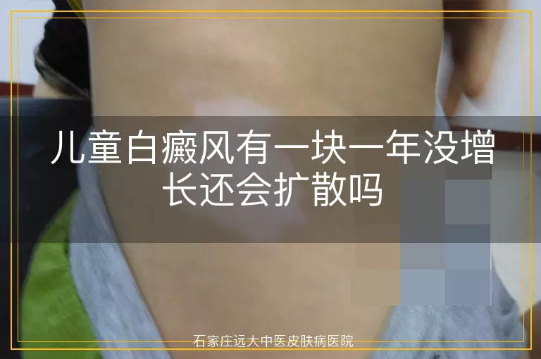 儿童白癜风有一块一年没增长还会扩散吗