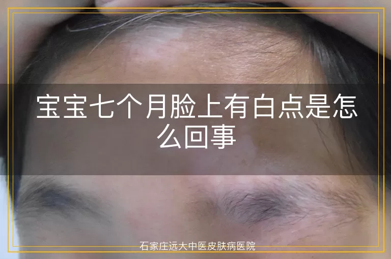 宝宝七个月脸上有白点是怎么回事