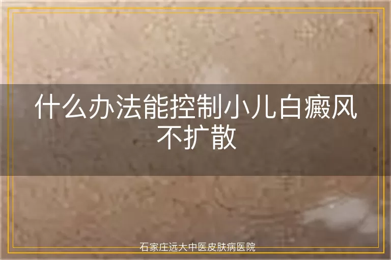 什么办法能控制小儿白癜风不扩散