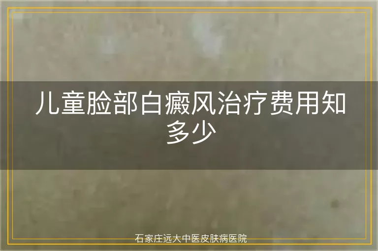 儿童脸部白癜风治疗费用知多少