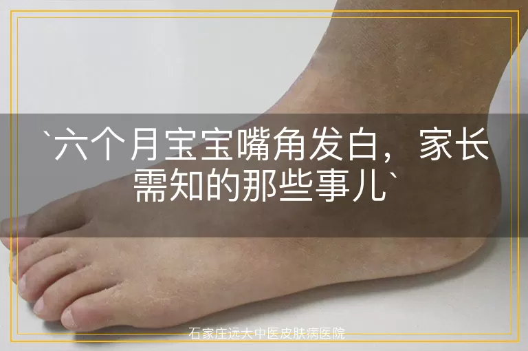 六个月宝宝嘴角发白，家长需知的那些事儿
