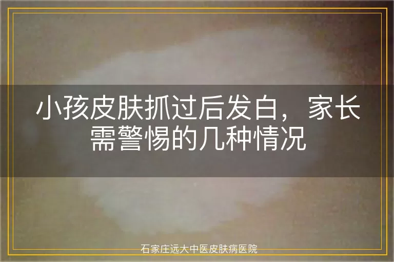 小孩皮肤抓过后发白，家长需警惕的几种情况
