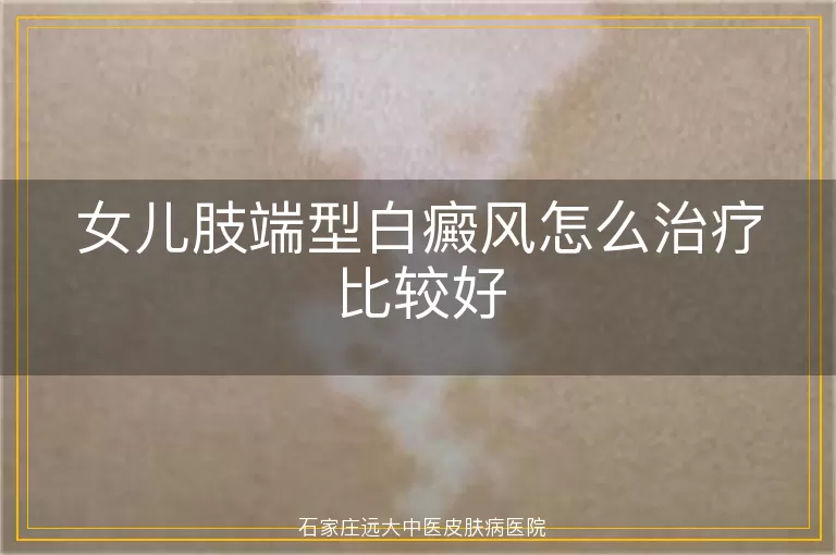 女儿肢端型白癜风怎么治疗比较好