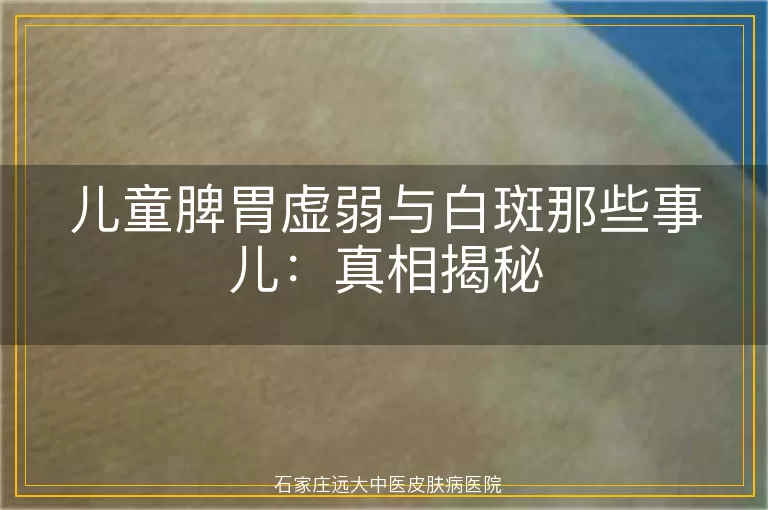 儿童脾胃虚弱与白斑那些事儿：真相揭秘