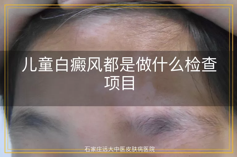儿童白癜风都是做什么检查项目