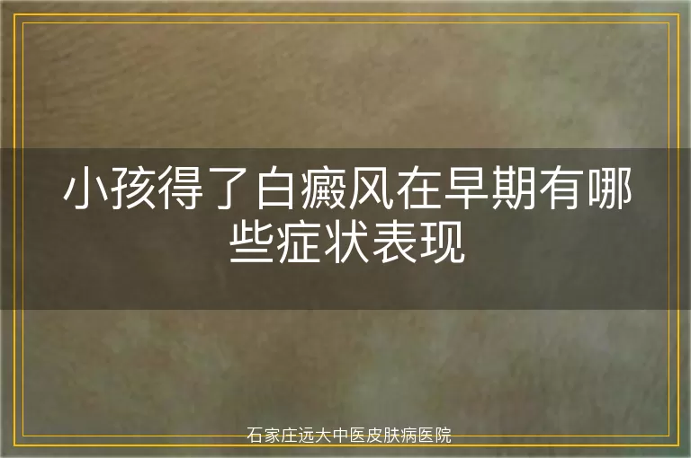小孩得了白癜风在早期有哪些症状表现