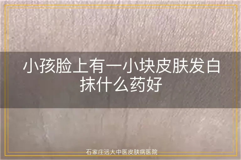 小孩脸上有一小块皮肤发白抹什么药好