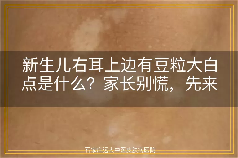 新生儿右耳上边有豆粒大白点是什么？家长别慌，先来看看这个