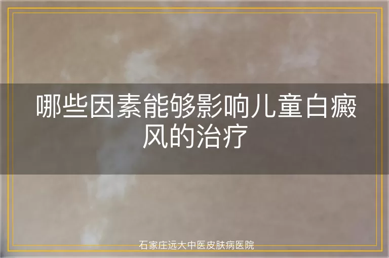哪些因素能够影响儿童白癜风的治疗