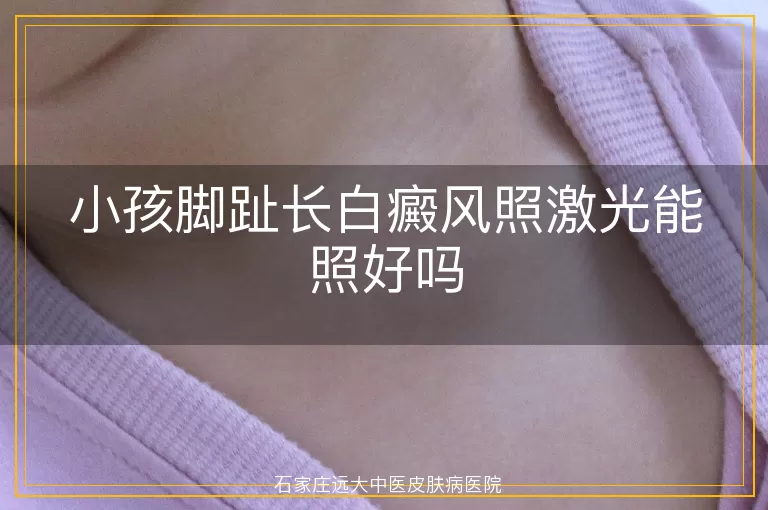 小孩脚趾长白癜风照激光能照好吗