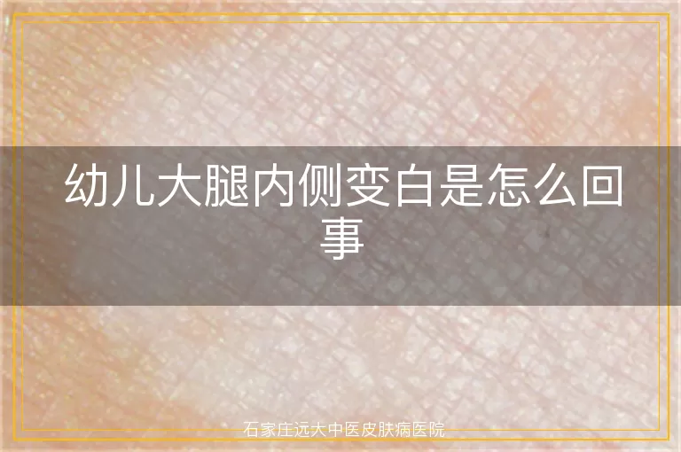 幼儿大腿内侧变白是怎么回事