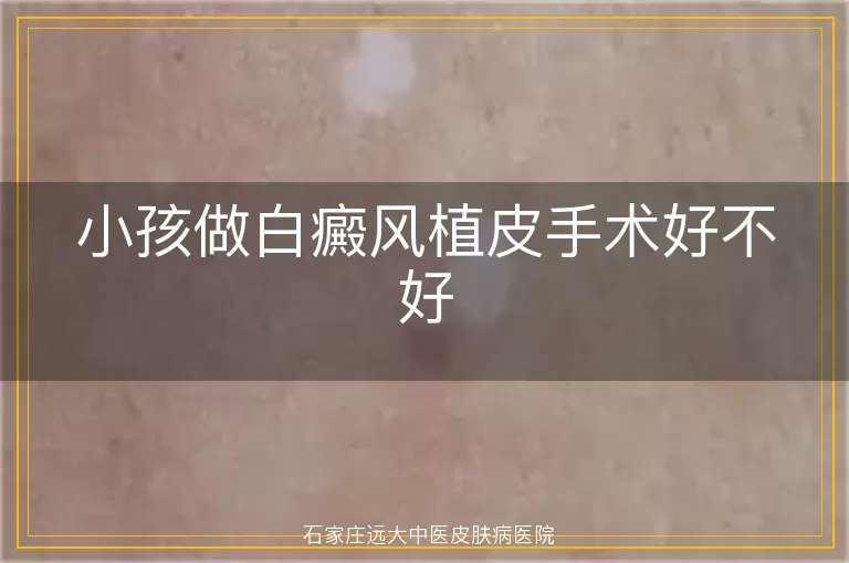 小孩做白癜风植皮手术好不好