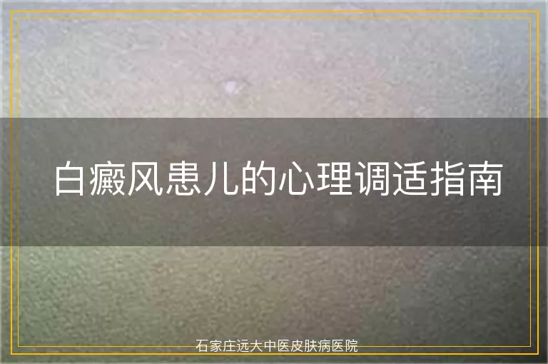 白癜风患儿的心理调适指南