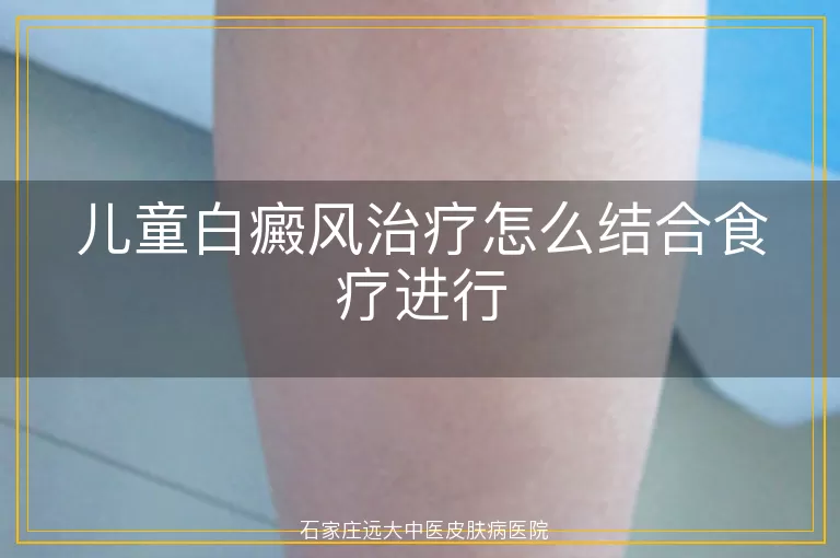 儿童白癜风治疗怎么结合食疗进行